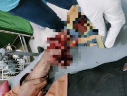 Akibat Petasan Rakitan, Security BMKG Mengalami Luka Parah di Tangan