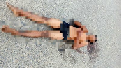 Pria Tanpa Identitas Ditemukan Tak Sadarkan Diri, Wajah Lebam Diduga Bekas Penganiayaan