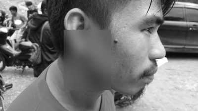 Aksi Unjuk Rasa di PT SCM Berujung Ricuh, Seorang Warga Routa Alami Luka