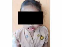 Oknum Guru SDN Waiti Barat Wakatobi Diduga Aniaya Siswinya Hingga Bibir Bengkak