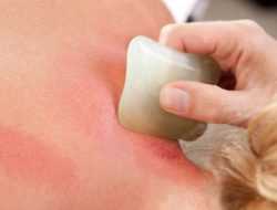 Bahaya Kerokan, Bisa Picu Infeksi hingga Iritasi Kulit