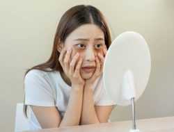 Jangan Diabaikan, Ini 6 Efek Jika Sering Begadang untuk Wajah