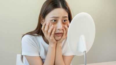 Jangan Diabaikan, Ini 6 Efek Jika Sering Begadang untuk Wajah