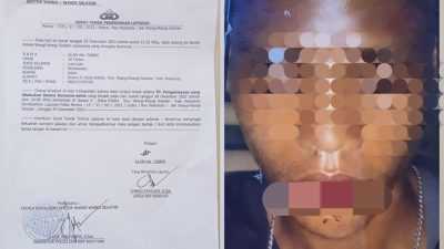 Pemuda di Wakatobi Dikeroyok Saat Pulang Dari Acara Joget