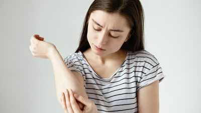 Simak Tips Ampuh Mengatasi Kulit Kering, Mau Coba?