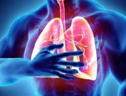 Mengenal Kebiasaan yang Dapat Tingkatkan Risiko Kena Paru-paru Basah