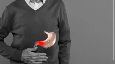 Ini Sederet Langkah Pertolongan Pertama Jika Asam Lambung Naik