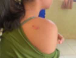 Siswi SMP di Konsel Jadi Korban Perundungan, Keluarga Lapor Polisi