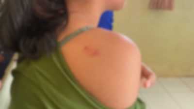 Siswi SMP di Konsel Jadi Korban Perundungan, Keluarga Lapor Polisi