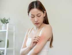 8 Cara Efektif Menghilangkan Biang Keringat