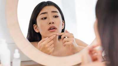 Berikut Ini Penyebab Munculnya Jerawat di Wajah