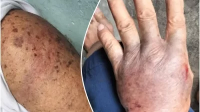 Oknum Pegawai Pajak yang Diduga Aniaya Pensiunan di Kendari Belum Ditahan